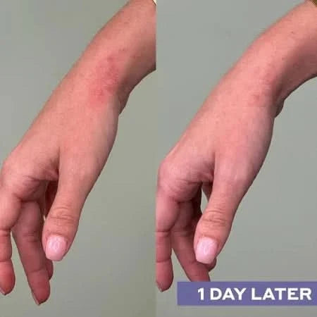 Daily SOS ansigtsspray med hypoklorsyre – Delune