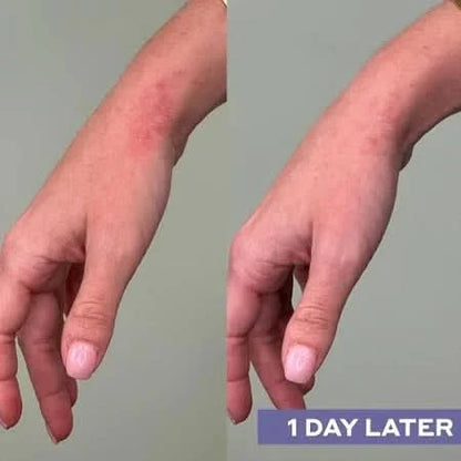 Daily SOS ansigtsspray med hypoklorsyre – Delune