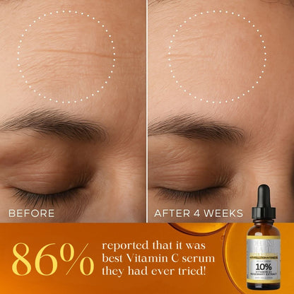 Super Vitamin C™ opklarende olie med 10 % C-vitamin – Delune